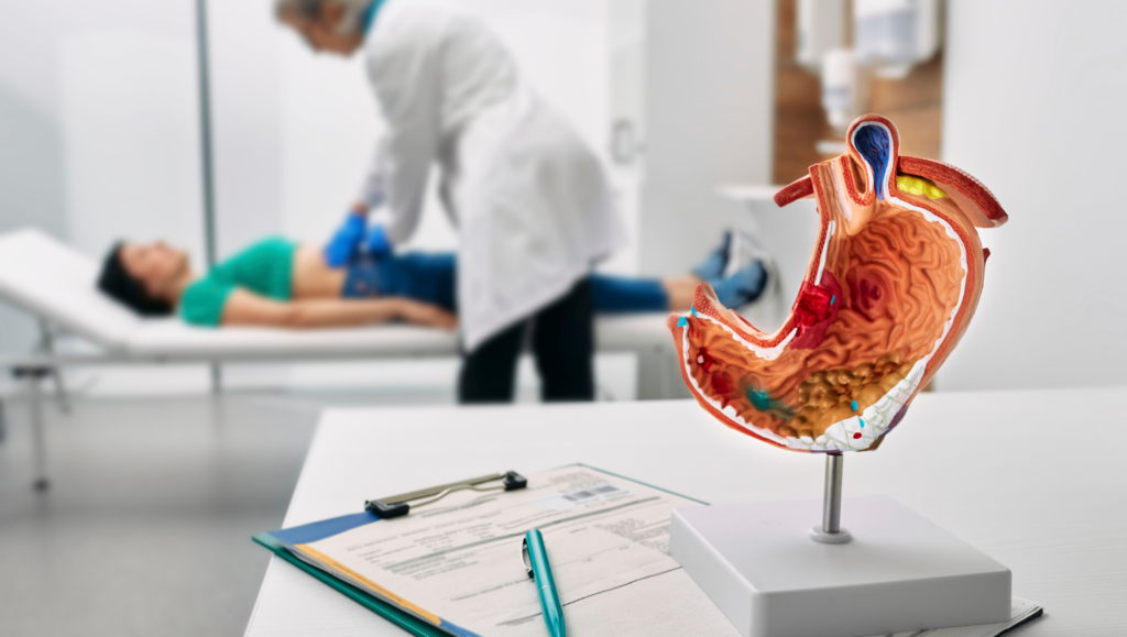 Šta je gastritis? Simptomi, uzroci i lečenje