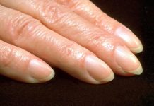 Mislite da je beli polumesec na noktima beznačajan? Pogledajte malo bolje – stručnjaci otkrivaju šta on znači