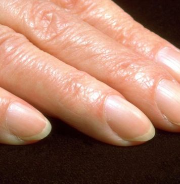 Mislite da je beli polumesec na noktima beznačajan? Pogledajte malo bolje – stručnjaci otkrivaju šta on znači