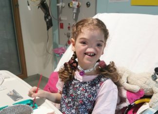 OVA DEVOJČICA JE ROĐENA BEZ NOSA: Prošla je kroz PAKAO da bi imala normalan život, a POGLEDAJTE SAMO kako danas izgleda