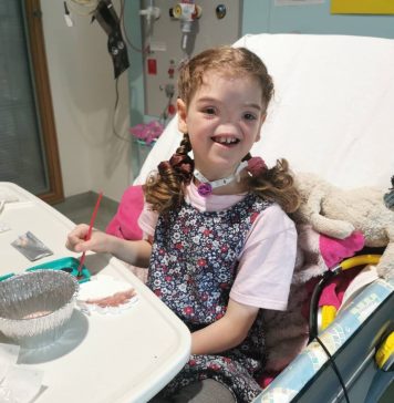 OVA DEVOJČICA JE ROĐENA BEZ NOSA: Prošla je kroz PAKAO da bi imala normalan život, a POGLEDAJTE SAMO kako danas izgleda