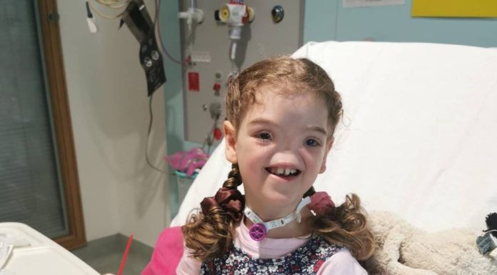 OVA DEVOJČICA JE ROĐENA BEZ NOSA: Prošla je kroz PAKAO da bi imala normalan život, a POGLEDAJTE SAMO kako danas izgleda