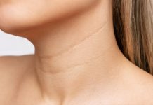 Bore na vratu sprečite uz 4 najdelotvornija sastojka za negu kože