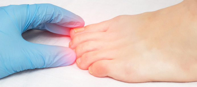 IMATE URASLI NOKAT?! – Ovako za samo 2 minute riješite nelagodu i bol! - featured image IMATE URASLI NOKAT?! – Ovako za samo 2 minute riješite nelagodu i bol! - featured image