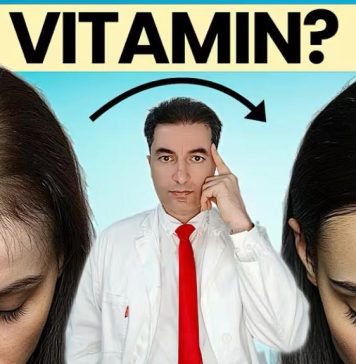 OPASNO: Deficit ovog vitamina UZROKUJE gubitak kose kod žena ! OPASNO: Deficit ovog vitamina UZROKUJE gubitak kose kod žena ! - featured image