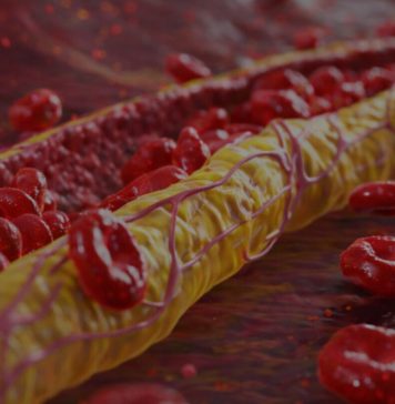 Ovi znaci na nogama pokazuju da imate izuzetno visok holesterol: Ne smijete ih ignorisati, posljedice su fatalne po tijelo Ovi znaci na nogama pokazuju da imate izuzetno visok holesterol: Ne smijete ih ignorisati, posljedice su fatalne po tijelo - featured image