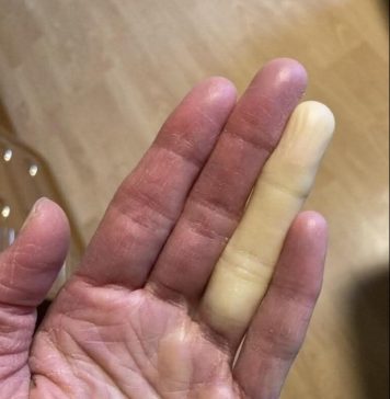 Ovo su posljedice spavanja sa… Ovo su posljedice spavanja sa… - featured image