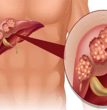 Koji su vidljivi znakovi disfunkcije jetre na koži i nogama? OVO SU ZNAKOVI BOLESTI KOJA POGODAVA JETRU…PRESTANITE SE ZEZATI