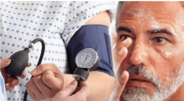 IZNENADA VAM JE SKOČIO PRITISAK: Ove namirnice u kući su prva pomoć! MORATE ZNATI! IZNENADA VAM JE SKOČIO PRITISAK: Ove namirnice u kući su prva pomoć! MORATE ZNATI! - featured image