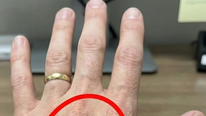 Ako imaš vidljive vene, to znači da si…😨😨‼️ Ako imaš vidljive vene, to znači da si…😨😨‼️ - featured image