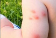 KOMARCI VAM PRAVE PAKAO OD ŽIVOTA? Samo isijecite OVO VOĆE na pola i ostavite u sobi, VIŠE IH NIKADA NEĆETE VIDJETI BLIZU! KOMARCI VAM PRAVE PAKAO OD ŽIVOTA? Samo isijecite OVO VOĆE na pola i ostavite u sobi, VIŠE IH NIKADA NEĆETE VIDJETI BLIZU! - featured image