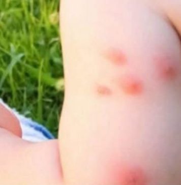KOMARCI VAM PRAVE PAKAO OD ŽIVOTA? Samo isijecite OVO VOĆE na pola i ostavite u sobi, VIŠE IH NIKADA NEĆETE VIDJETI BLIZU! KOMARCI VAM PRAVE PAKAO OD ŽIVOTA? Samo isijecite OVO VOĆE na pola i ostavite u sobi, VIŠE IH NIKADA NEĆETE VIDJETI BLIZU! - featured image