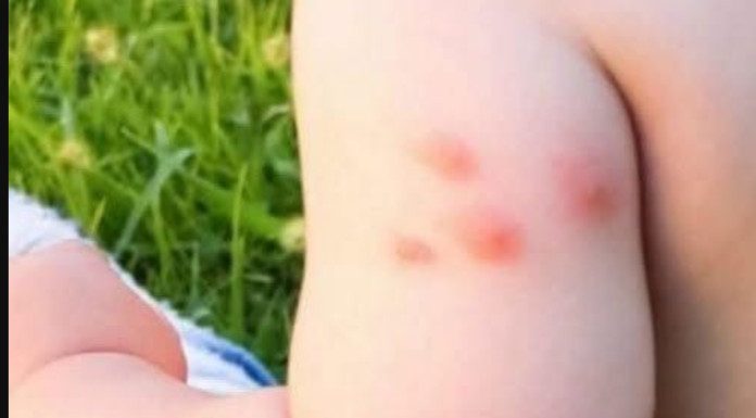 KOMARCI VAM PRAVE PAKAO OD ŽIVOTA? Samo isijecite OVO VOĆE na pola i ostavite u sobi, VIŠE IH NIKADA NEĆETE VIDJETI BLIZU! KOMARCI VAM PRAVE PAKAO OD ŽIVOTA? Samo isijecite OVO VOĆE na pola i ostavite u sobi, VIŠE IH NIKADA NEĆETE VIDJETI BLIZU! - featured image