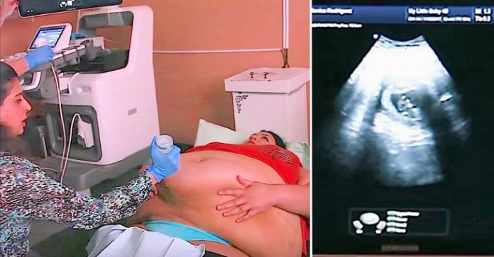 Trudna žena ima 226 kilograma i došla je na ultrazvuk, a onda je medicinska sestra podigla njen stomak i pogledala bolje… (VIDEO) Trudna žena ima 226 kilograma i došla je na ultrazvuk, a onda je medicinska sestra podigla njen stomak i pogledala bolje… (VIDEO) - featured image
