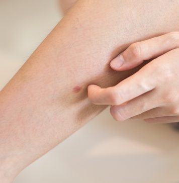 „Šta uzrokuje svrab na različitim dijelovima tijela: kada je bezopasan, a kada potražiti savjet ljekara“ „Šta uzrokuje svrab na različitim dijelovima tijela: kada je bezopasan, a kada potražiti savjet ljekara“ - featured image