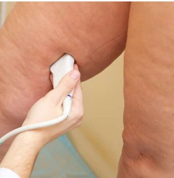 Kako prepoznati manjak vitamina D: znakovi koje tijelo šalje prije nego što nastanu veći problemi Kako prepoznati manjak vitamina D: znakovi koje tijelo šalje prije nego što nastanu veći problemi - featured image
