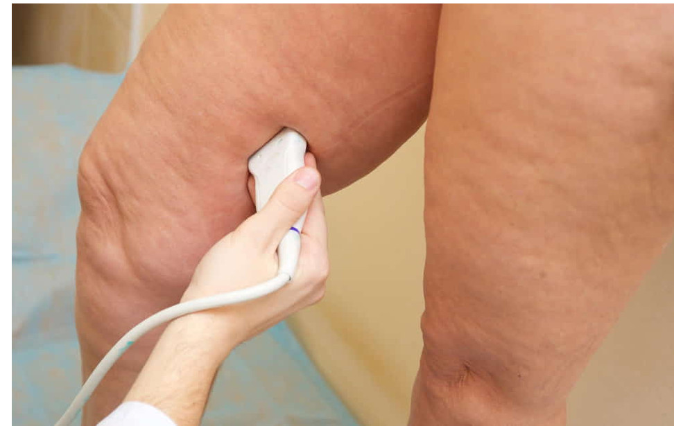 Kako prepoznati manjak vitamina D: znakovi koje tijelo šalje prije nego što nastanu veći problemi - featured image Kako prepoznati manjak vitamina D: znakovi koje tijelo šalje prije nego što nastanu veći problemi - featured image