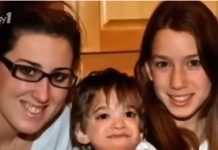 Ova devojčica uopšte nije starila, sa 20 godina sve je frapirala izgledom: Dok su lekari pokušavali da shvate šta se dešava, roditelji povukli šok potez Ova devojčica uopšte nije starila, sa 20 godina sve je frapirala izgledom: Dok su lekari pokušavali da shvate šta se dešava, roditelji povukli šok potez - featured image