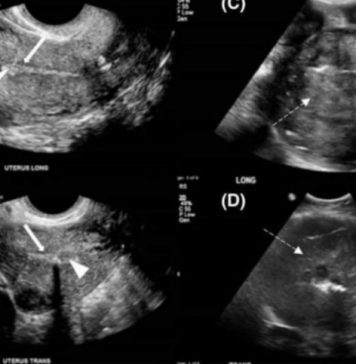 OD RAKA MATERICE UMIRE SVE VEĆI BROJ ŽENA: 6 jasnih signala da se u tijelu razvija ovaj opasan tumor! OD RAKA MATERICE UMIRE SVE VEĆI BROJ ŽENA: 6 jasnih signala da se u tijelu razvija ovaj opasan tumor! - featured image