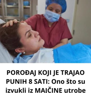 POROĐAJ KOJI JE TRAJAO PUNIH 8 SATI: Ono što su izvukli iz MAJČINE utrobe zaprepastilo je sve doktore (FOTO) POROĐAJ KOJI JE TRAJAO PUNIH 8 SATI: Ono što su izvukli iz MAJČINE utrobe zaprepastilo je sve doktore (FOTO) - featured image